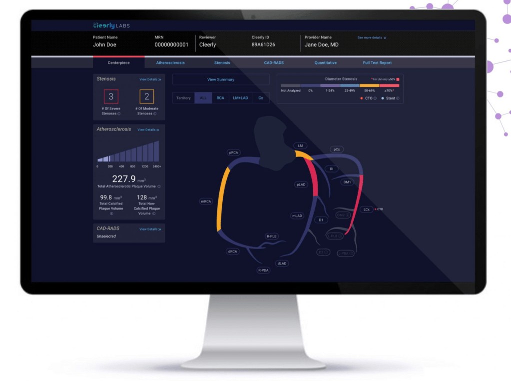 Heart Disease Screening Startup Raises $43M Series B