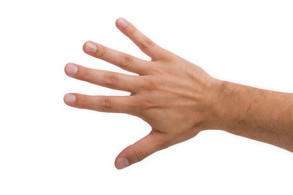 Sanguina: Fingernail Selfies as Iron Deficiency Test