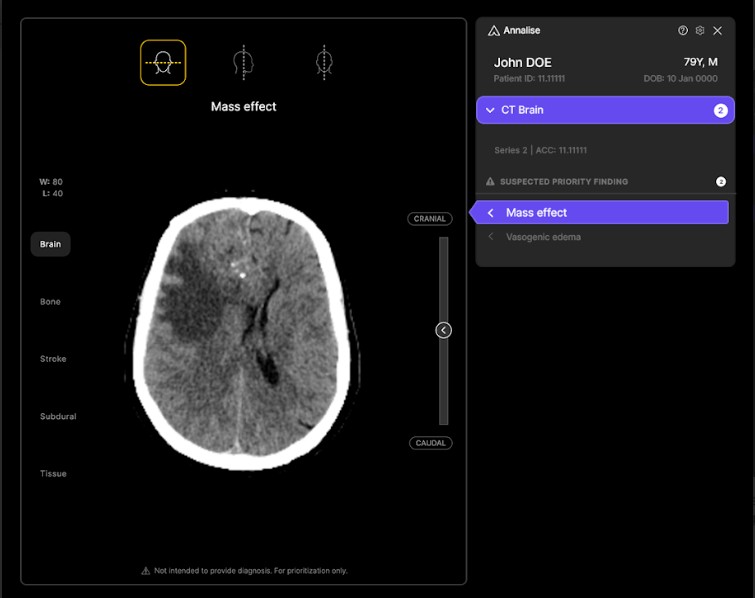 Harrison.ai Secures $112M Series C Funding - Australian Health Tech