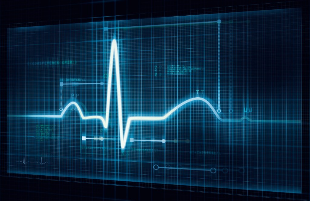 Cardiomatics Secures $3.2M Funding for ECG-Reading AI