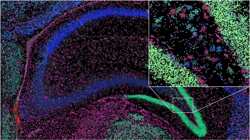 Deep Science: Alzheimer's, Drones, Machine Learning & More