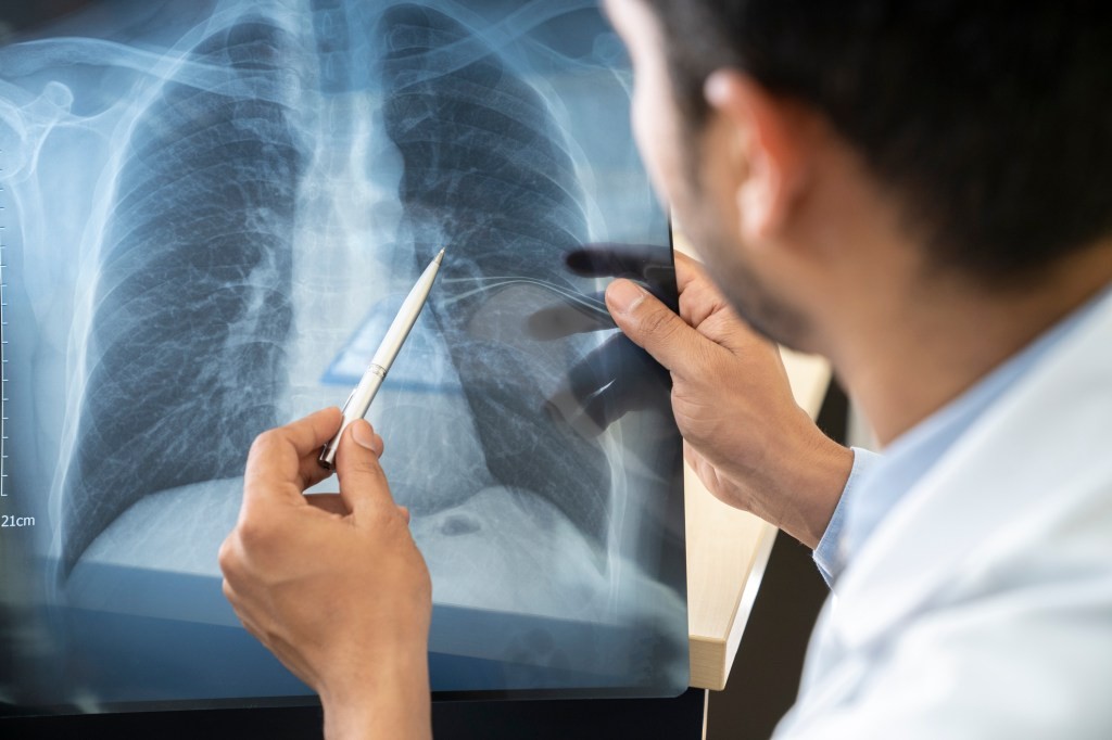 Endeavor Biomedicines Secures $62M to Fight Pulmonary Disease