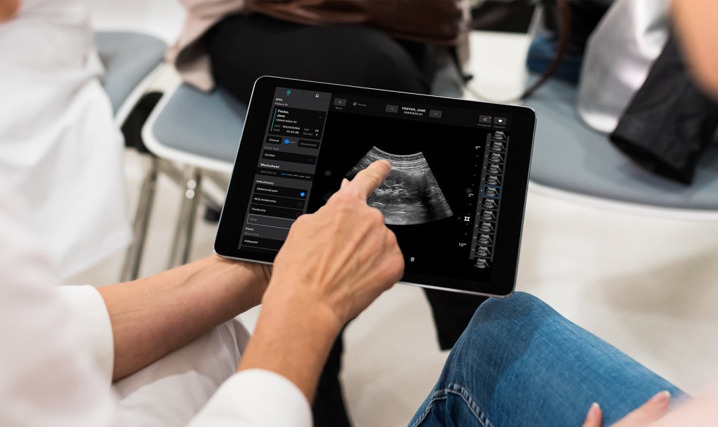 Exo Raises $200M to Commercialize Ultrasound Device