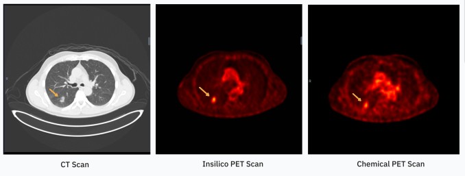 oxford spinout radicait uses ai to make diagnostic imaging more affordable and accessible — catch it at techcrunch disrupt 2025