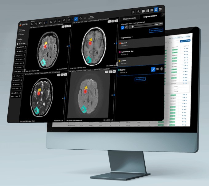 quibim raises $50m to develop ai models for medical imaging