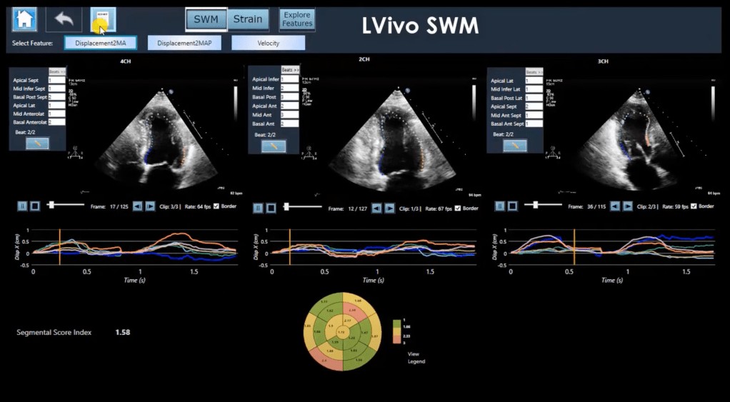 DIA Receives $14M to Expand AI Ultrasound Analysis | Israel