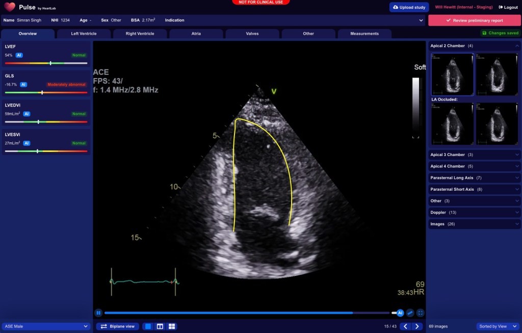 New Zealand Startup HeartLab Raises $2.45M for US Expansion