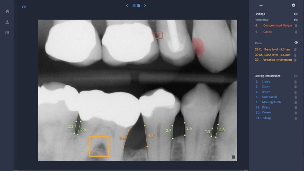 Overjet Secures New Funding for Dental AI Technology