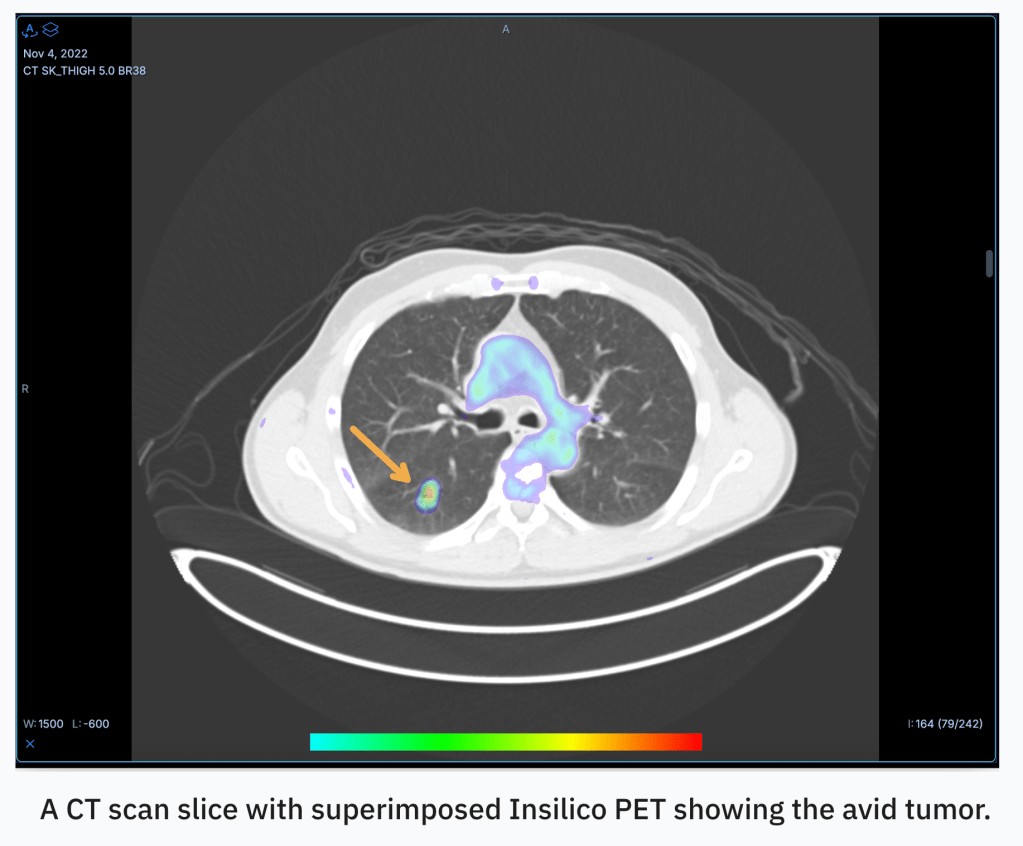 Radicait: AI-Powered Affordable Diagnostic Imaging | TechCrunch Disrupt 2025