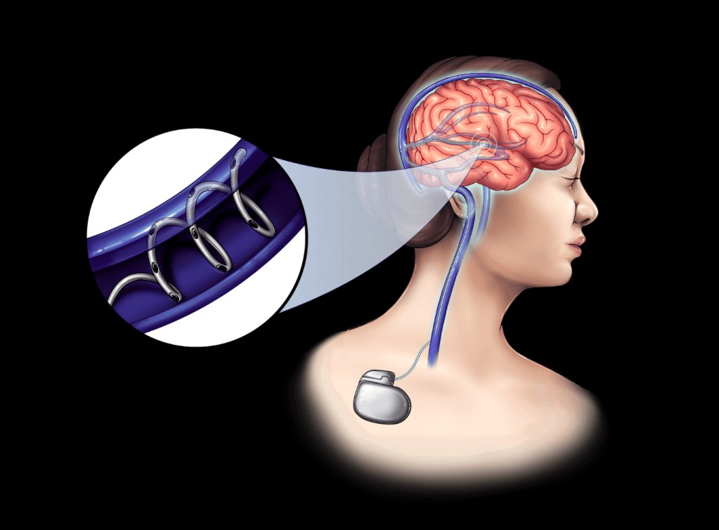 MIT Spinout Developing Brain Implants with Hair-Thin Fibers