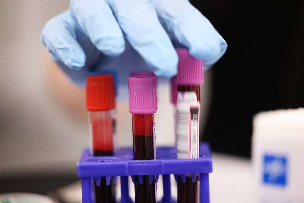 Ransomware Attack Disrupts US Blood Donation Giant